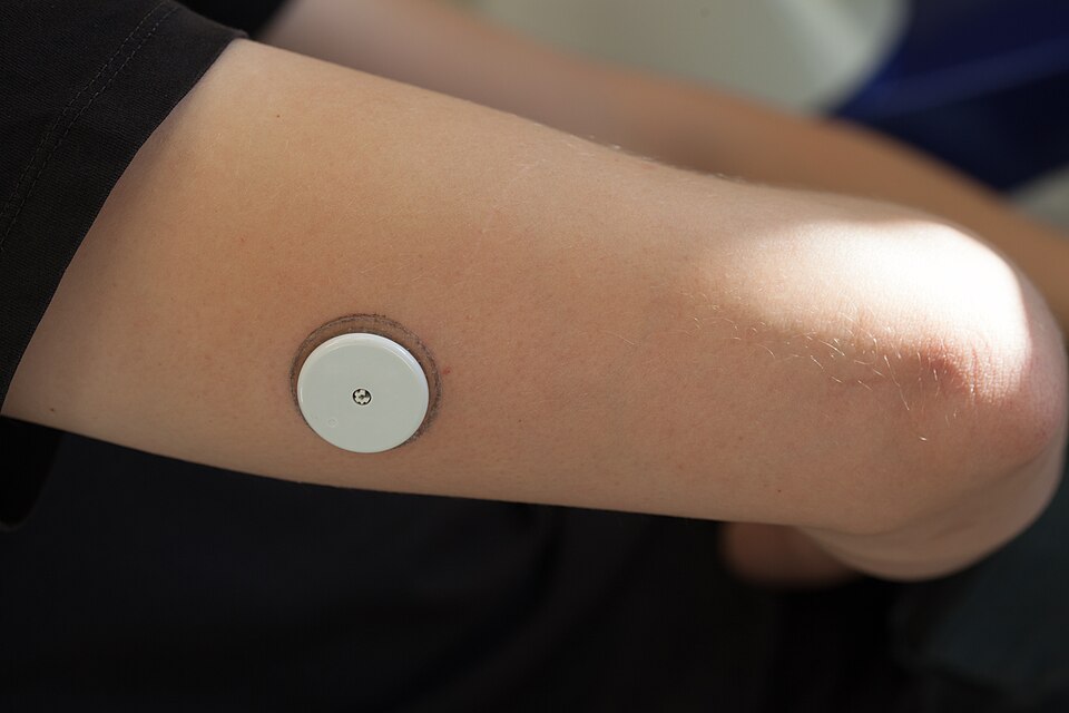 A FreeStyle Libre continuous glucose monitor sensor on a person's upper arm